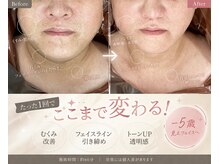 ティースキンサロンオキナワ(T-skin salon Okinawa)