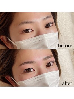 ダリ(Dali)/ハリウッドブロウリフト