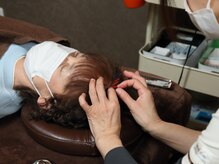 やまざき鍼灸整骨院/☆再生増毛鍼灸