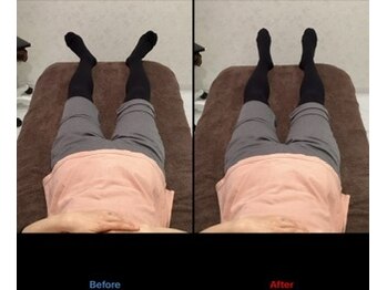 レピア 夙川本店(Lepia)/足の歪みなくすらっとした足に