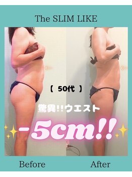 スリムライク 鳥取店(The SLIM LIKE)/痩身ビフォーアフター