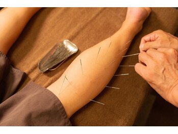 はりひろし鍼灸院/足のむくみ