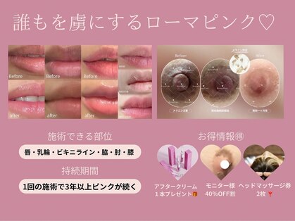 リラクゼーション つぼみの写真