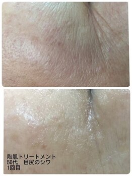 エルヴェ(Eleve)/乾燥小ジワにアプローチ