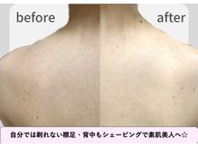 【Shaving&Bridal Shaving】salon.de.SHILO 麻布十番/背中のシェービング[麻布十番]