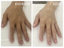 キレイテ 上野店/50代/6回目【ハンドケア稲荷町】