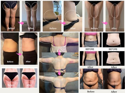 エノアシュエット(Enoachouette)の写真