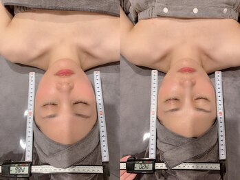 R-1ビューティーサロン 表参道/お顔の歪みをチェック
