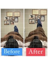 ナオル整体 宮崎院(NAORU整体)/20代女性施術事例【骨盤の歪み】