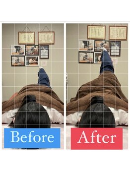 ナオル整体 宮崎院(NAORU整体)/20代女性施術事例【骨盤の歪み】