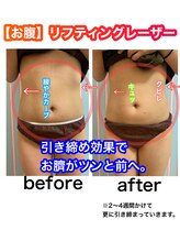 ビューティ ウィッチ(Beauty Witch)/無制限ショット◎