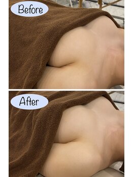 レナブルーム(Renabloom)/理想の美バストに