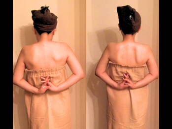 美座ノ女 梅田 淀屋橋本店/施術前後(背面)