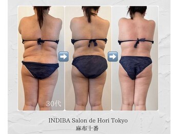 インディバホリトウキョウ(INDIBA HORI TOKYO)/健康を伴ってこそ本当の美しさ