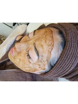 シミしわ改善！予防ケア