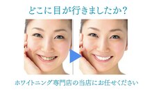 【歯科提携】歯のホワイトニング専門店 ホワイトニングサロン宝塚