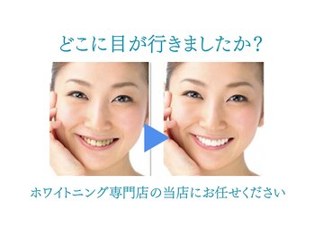 ホワイトニングサロン 宝塚