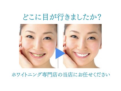 【歯科提携】歯のホワイトニング専門店 ホワイトニングサロン宝塚の写真