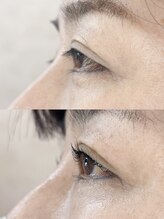 ダーム ド ローズ(Dame de rose)/【まぶたが上がるまつ毛パーマ】