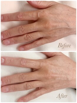 ソワン(soin)/Before→After