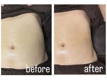 マハロ スコータイ/ビフォーアフター　＜お腹＞