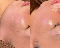 ひっそり美肌構築