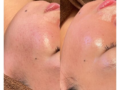ひっそり美肌構築の写真