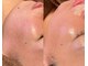 ひっそり美肌構築の写真