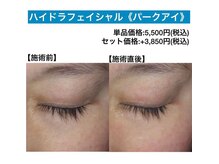 アクティブエイジング 大阪店/【ハイドラ】パークアイ