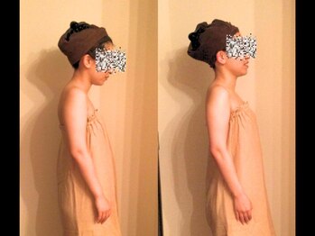 美座ノ女 梅田 淀屋橋本店/施術前後(横側)