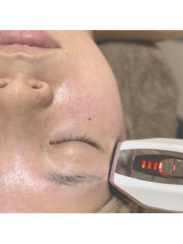 エース(ACE.)/冬の乾燥対策には美容液☆