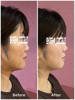 ココロ(CoCoLo)/ビフォーアフター