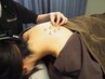 【ご予約専用】オーダー鍼灸60分[町田/鍼灸/腰痛/肩こり/首こり］