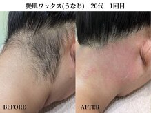 サンビ(SANBI)/うなじのケアもできます！