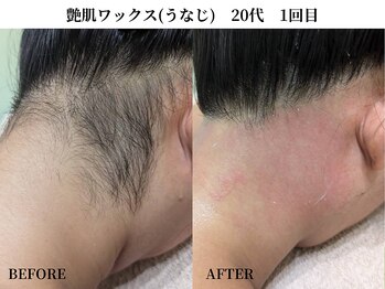 サンビ(SANBI)/うなじのケアもできます！