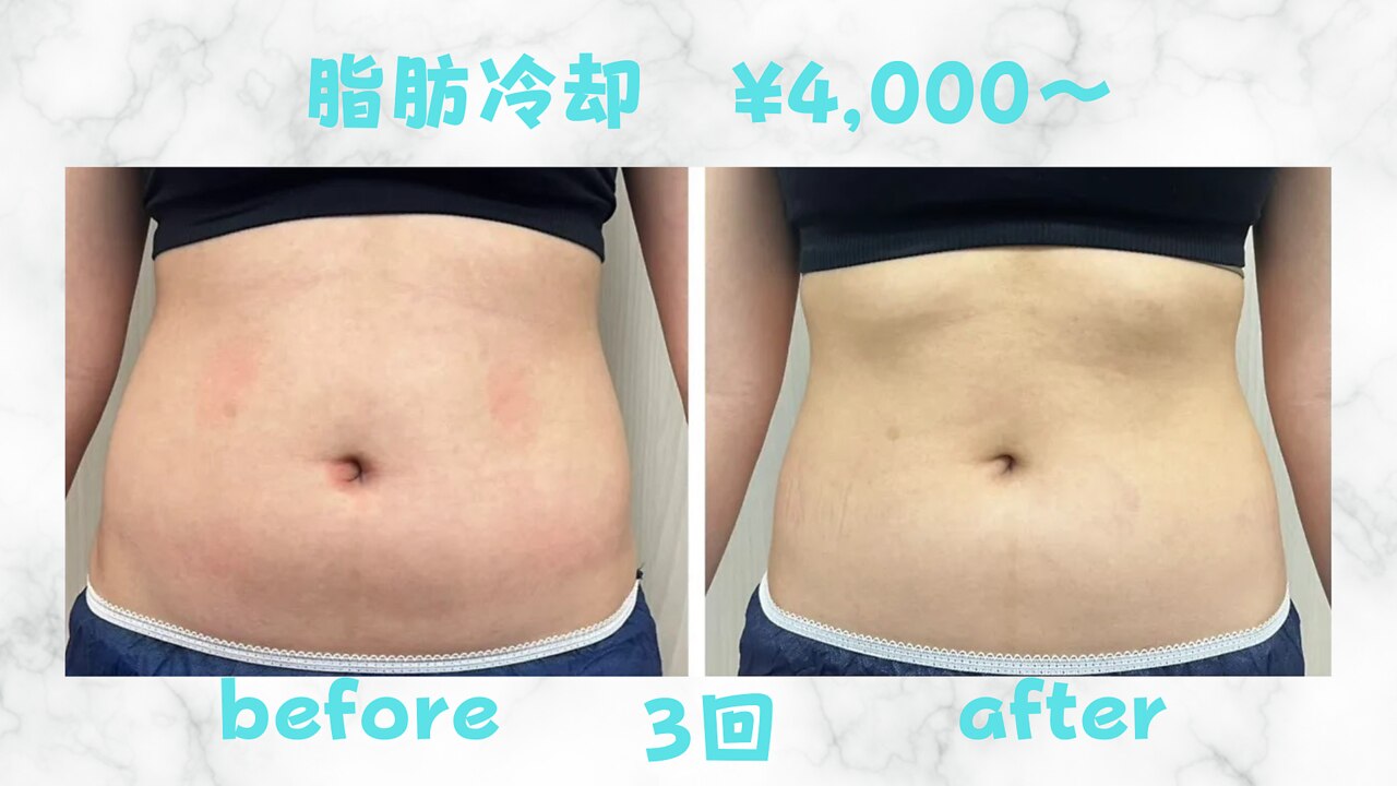 ネオン(Neon)｜ホットペッパービューティー