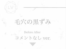 ラヴィオーラ 名駅(LaViora)/ダイヤモンドハーブピーリング