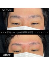 ユー 千葉駅前店(you)/ビフォ－アフター写真