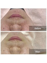 エステティックアウラジパング(Esthetic Aura Zipangu)/小顔フェイシャル