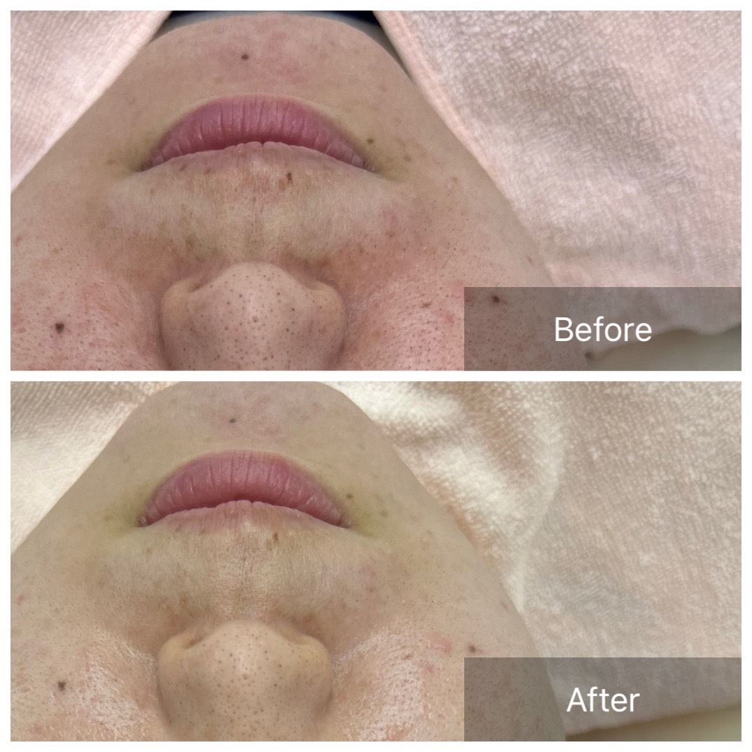 エステティックアウラジパング(Esthetic Aura Zipangu)/小顔フェイシャル