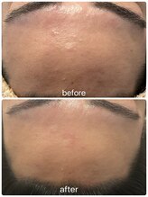 リリールア(Rere-Rua)/doc skin使用