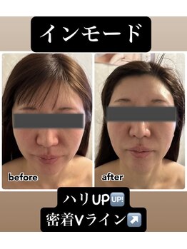 ミューズ よもぎ蒸し(MUSE)/◆インモード◆