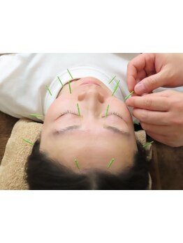 鍼灸施術を受けたい