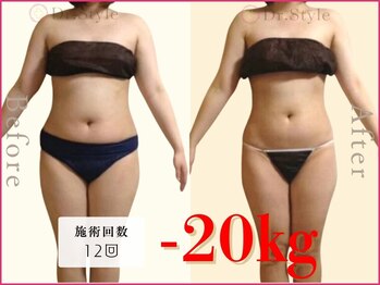 ココア整体 岐阜店(cocoa整体)/最新痩身マシン/脂肪燃焼リンパ