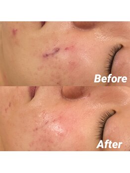 ロウエン(LAUEN)/