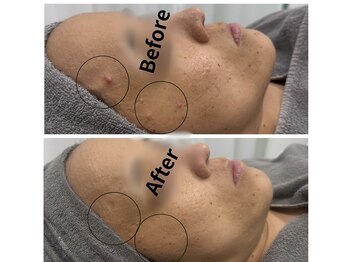 マヴィ(Mavie)/クリスティーナピーリング