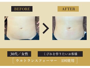 キレイ 筑紫野原田店(KIREI)/30代 くびれを作りたい