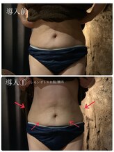 アイビー 亀田店(IVY)/【韓国発】脂肪分解レモンボトル