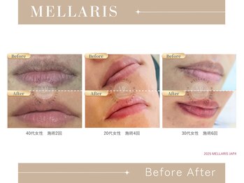 リノア 柏(Lino'a)/唇リップカラー自然なピンクへ♪