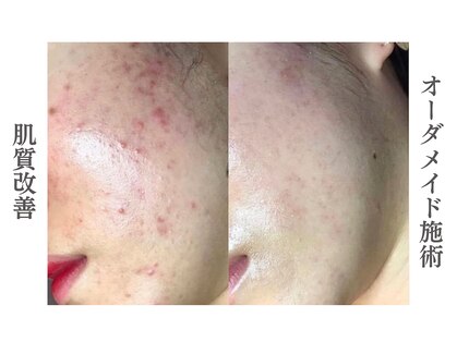 リアム(LiAm)の写真